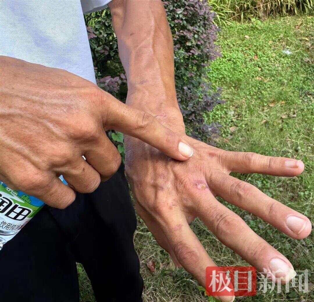 生意爆火赚得盆满钵满？鸡排哥谈收入笑称“还没赚到1个亿”